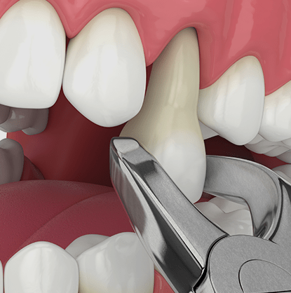 Treatment - Brimington Dental Practice