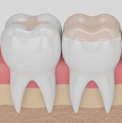 Treatment - Brimington Dental Practice