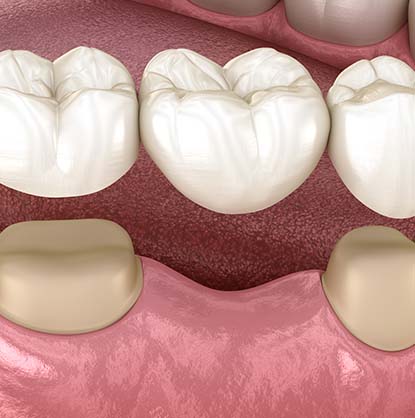Treatment - Brimington Dental Practice