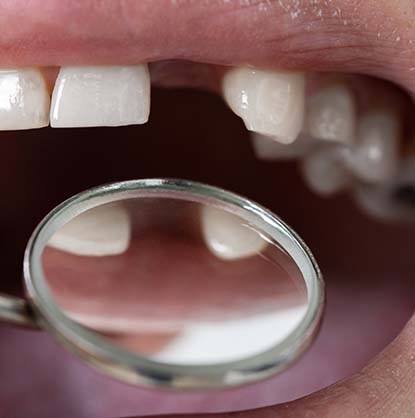Treatment - Brimington Dental Practice