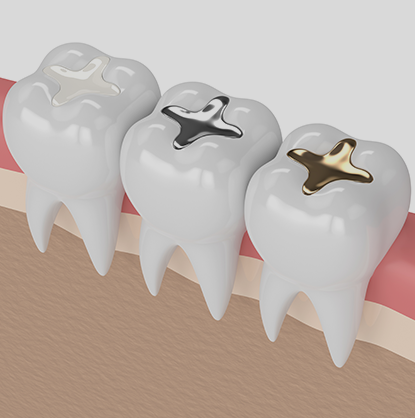 Treatment - Brimington Dental Practice